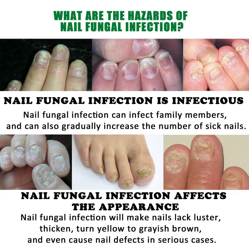 Jaysui Ginger Care dla miękkiego, jasnego, szarego, nawilżającego płynu do rąk, stóp i paznokci_voghion.com