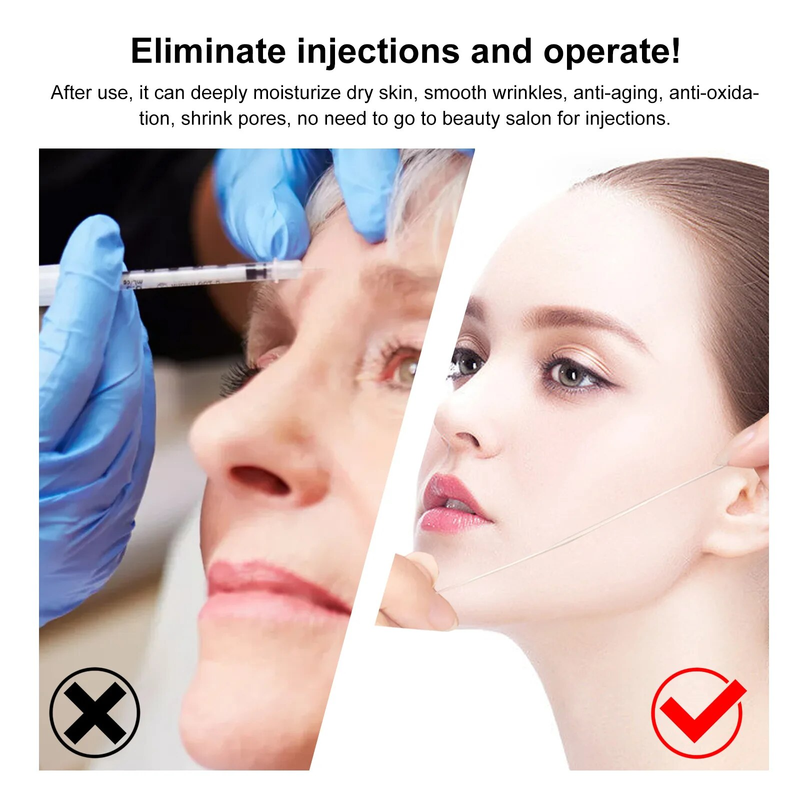Collagen Thread azonnali lifting ránctalanító oldható fehérjeszálak szérumkészlet felszívódó arcfeltöltő öregedésgátló bőr_voghion.com