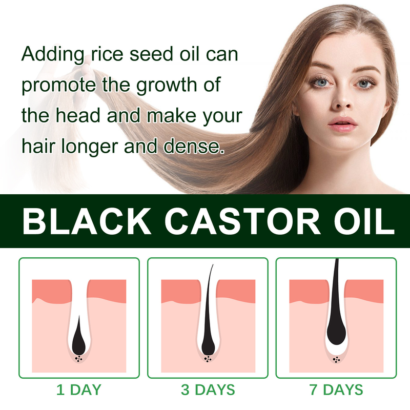 Hoegoa black castor essential oil dense delicate repairing smoothing hair, massaging the scalp and strengthening_voghion.com