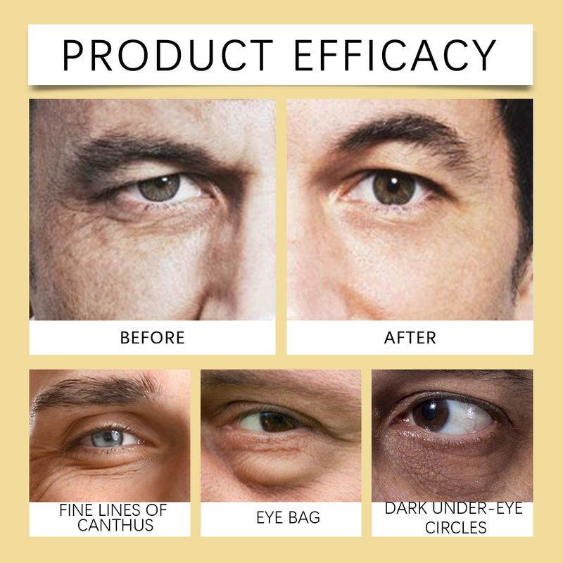 East Moon Caffeine Firming Eye Cream Hydrates, Lifts And Tightens The Skin Around The Eye_voghion.com