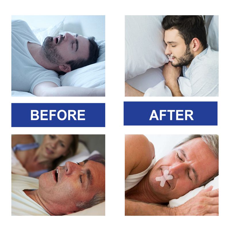 Nastro antirussamento, sigillatura del sonno, antirussamento, respirazione con apertura della bocca, cura del sonno, nastro per respirazione chiusa_voghion.com