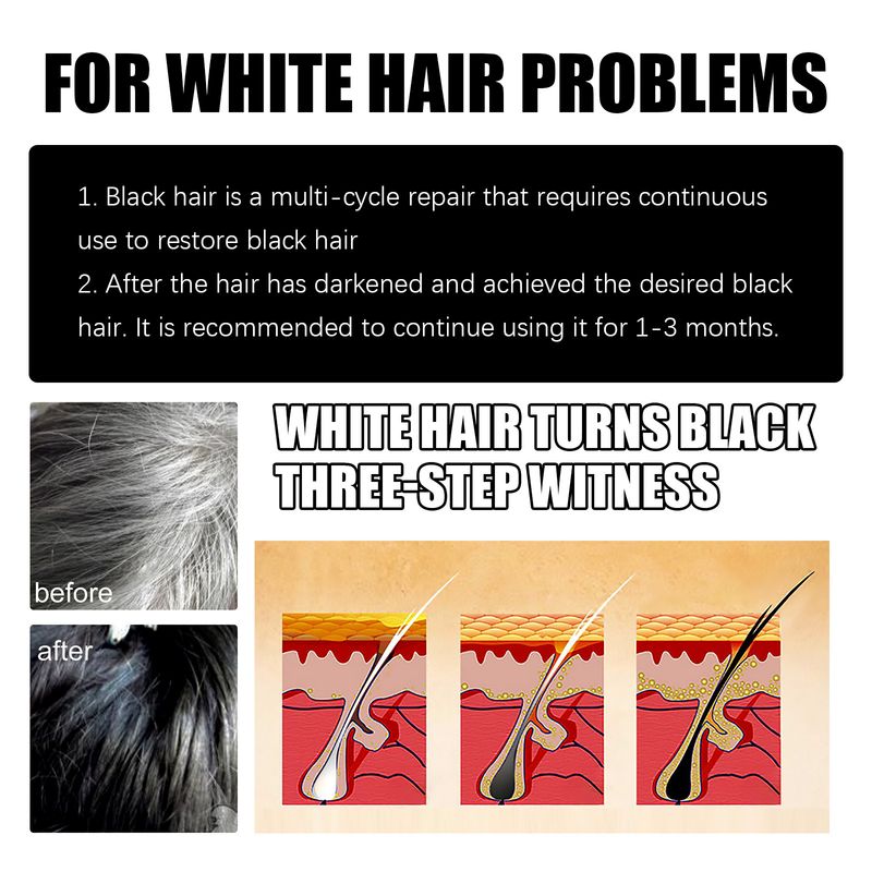 Polygonum multiflorum white to black shampoo deeply repairs, hair, removes dandruff, relieves itching, 2024 popular_voghion.com