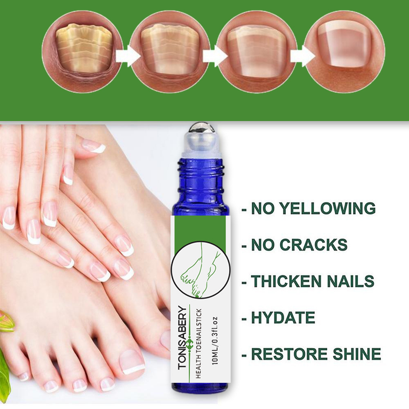 TONISABERY Special Grey Ball Repair roku un kāju barojošs nagu balināšanas essence antibakteriāls šķidrums_voghion.com