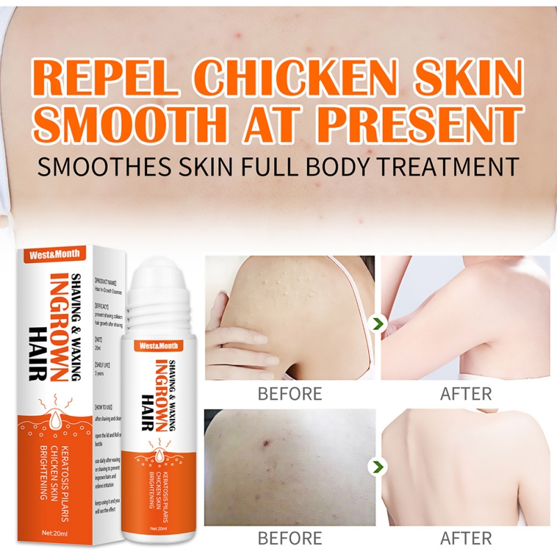 20ml Soluție ser reparator după ras Calmează epilarea cu ceară Păr crescut sub piele Reduce roșeața pielii Previne iritațiile de la ras Frumusețe și sănătate Sigură_voghion.com