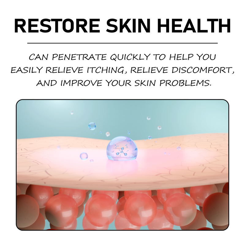 South Moon Zihua Di Ding Skin Antipruritus Tørr hud, kløe, rødhetslindrende fuktighetsgivende pleiekrem_voghion.com
