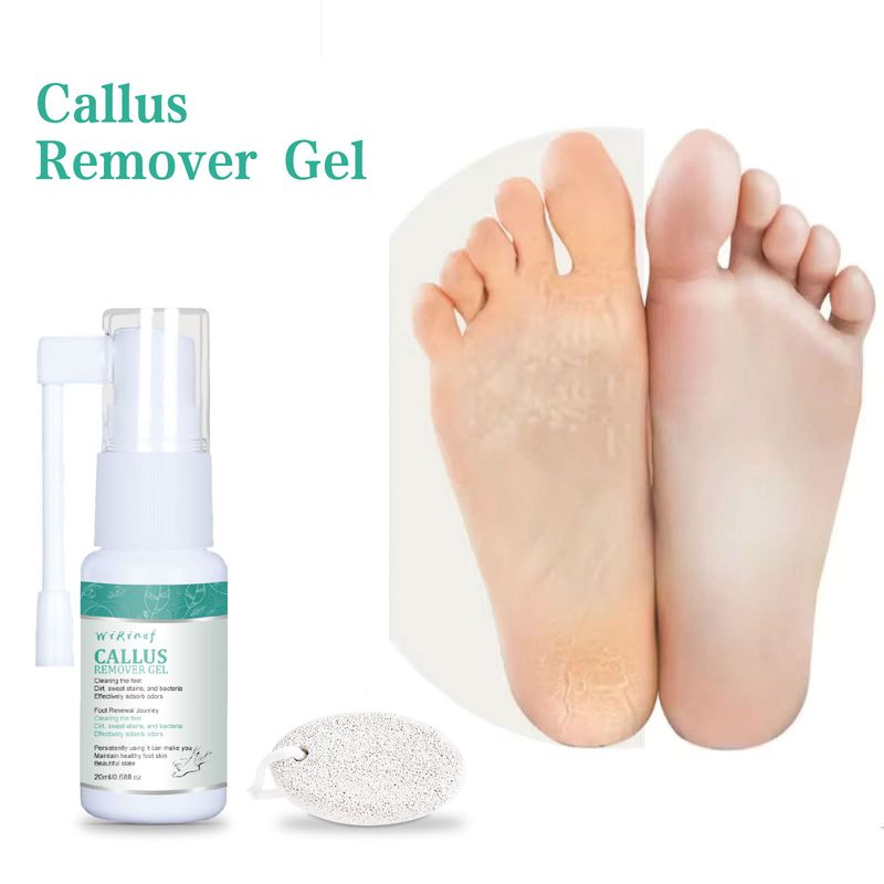 Spray Esfoliante Corpo, Mãos e Pés, Alivia a Pele Morta, Esfolia Hidrata e Limpa Profundamente_voghion.com