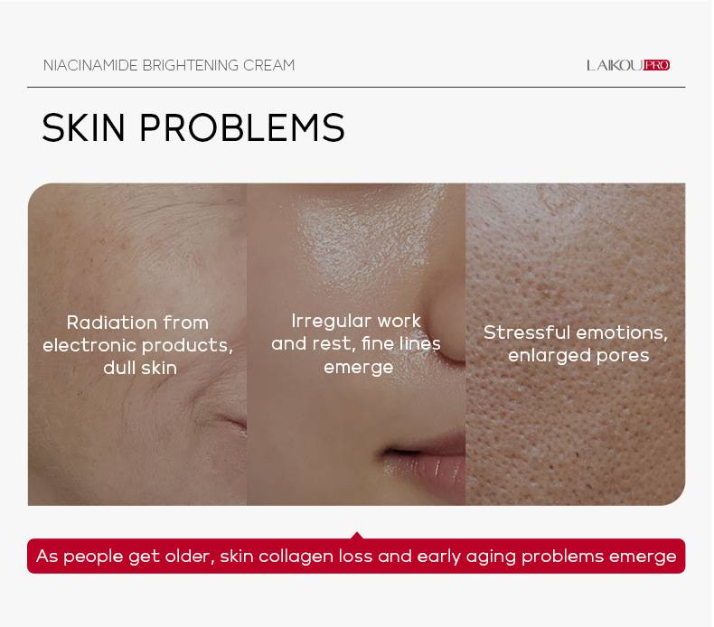 LAIKOU PRO Niacinamide Moisturizing Cream, 30g, Hydrating And Moisturizing Skincare Product._voghion.com
