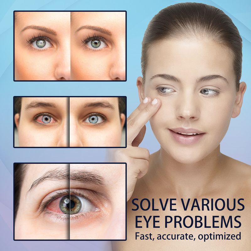 Gotas lubricantes para los ojos EELHOE: alivia el enrojecimiento, la fatiga ocular, la sequedad, la visión borrosa y humecta los ojos._voghion.com