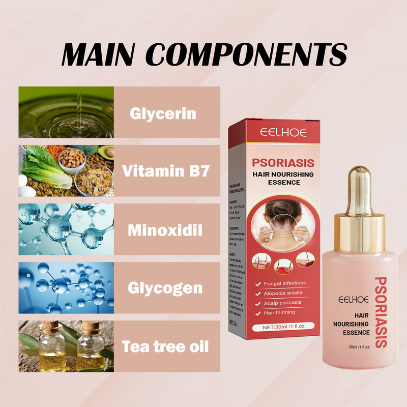 EELHOE cowhide moss hair care essence cleans scalp, dispels dandruff, relieves itching, refreshes, controls oil and_voghion.com