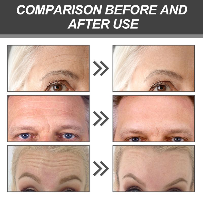 Hoygi Forehead Mask, Smooth Fine Lines On Your Forehead Forehead Brow Tattoo The Skin Smooth Forehead_voghion.com