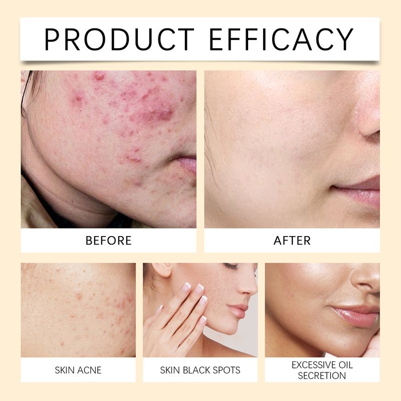 Reis Hunneg Feuchtigkeitsspenderend an ophellend Mask Feuchtigkeitsspenderend, hydratiséierend, pflegend a verbessert de Glanz vun der Gesiichtshaut_voghion.com