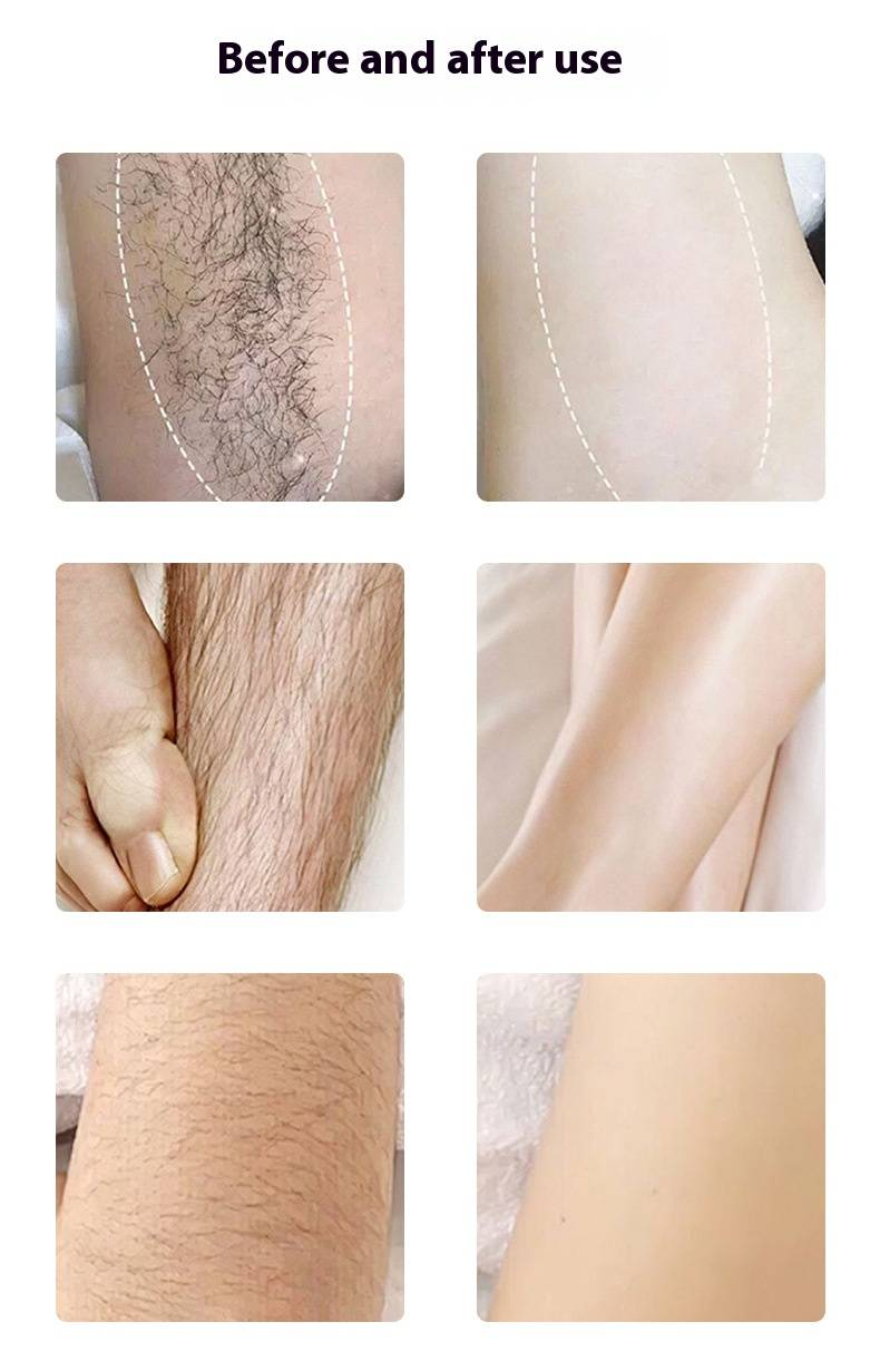 Tagliacapelli elettrico portatile per corpo e viso - Ricaricabile tramite USB, epilazione indolore per uomini e donne, compatto e adatto ai viaggi (bianco)_voghion.com