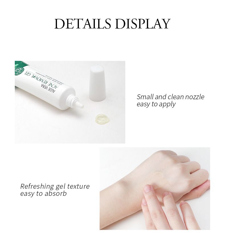 Trattamenti e maschere Crema anti-acne all'aloe vera 20 g Prodotti idratanti per la cura della pelle Confezione in inglese_voghion.com