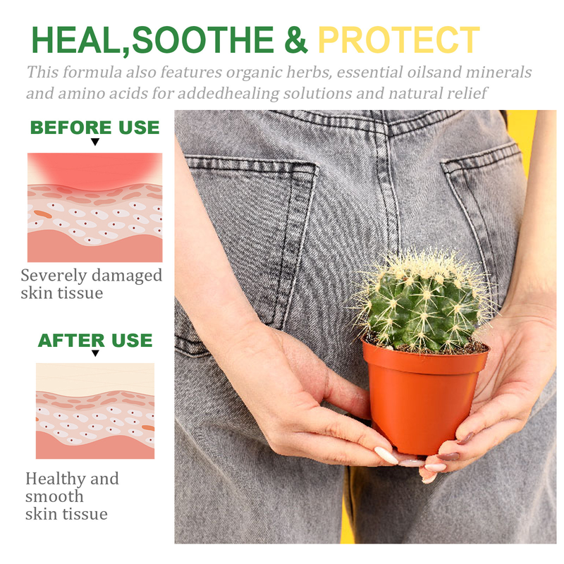 Cremă pentru hemoroizi Relief Beautiful pentru repararea analului, îndepărtarea lânii, ameliorarea umflăturilor, hemoroizi, dureri, ,_voghion.com