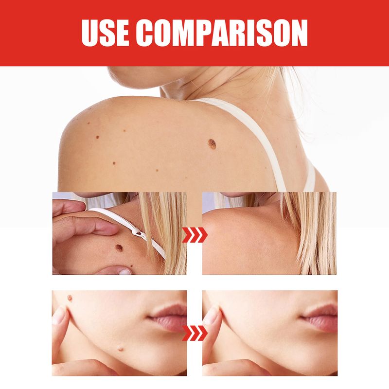 Conjunto de cuidados com a pele EELHOE, pele corporal suave, limpeza suave, hidratante, cuidados externos, solução de cuidados_voghion.com