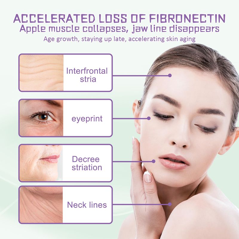 Hoygi Wrinkle Reducing Lifting Cream Reduces Eye Bags, Fine Lines, Anti-aging Skin, Smooth, Delicate, And Elastic_voghion.com