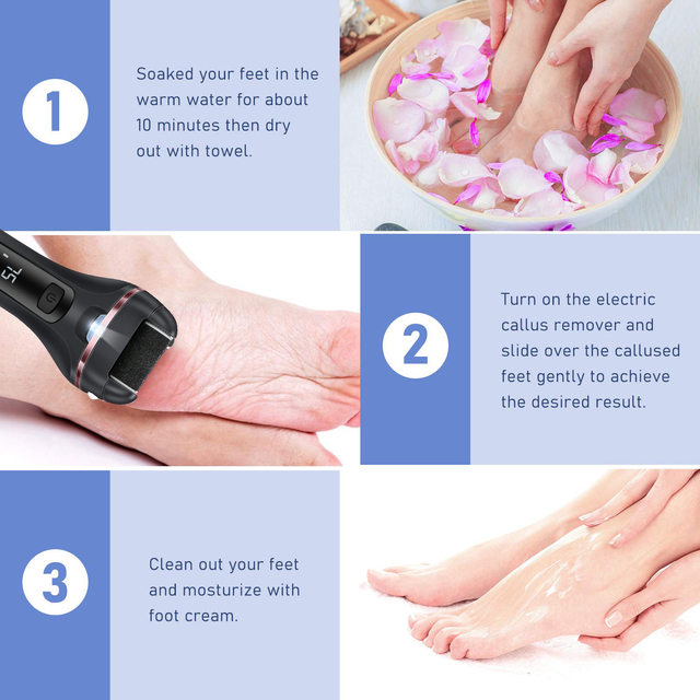 Lixa elétrica para pés, lixa para calcanhares, ferramentas de pedicure, ferramenta profissional de cuidados com os pés, removedor de calos de pele dura morta_voghion.com