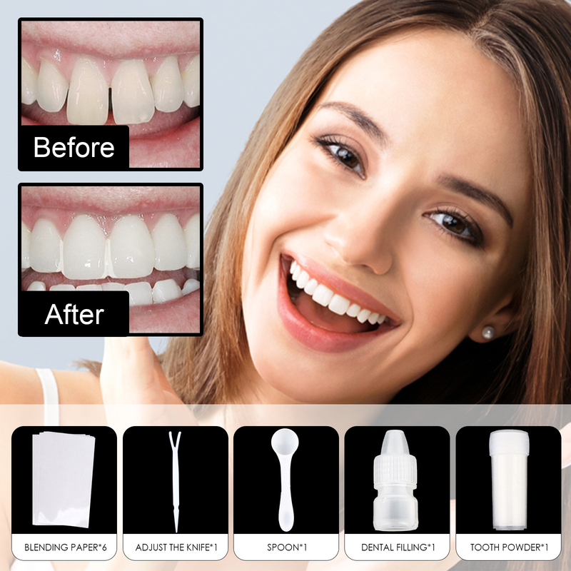 Set di gel Jaysuing dentale modellabile, trucco per feste, riempimento temporaneo dei fori dei denti, riempimento degli spazi tra i denti e protesi_voghion.com