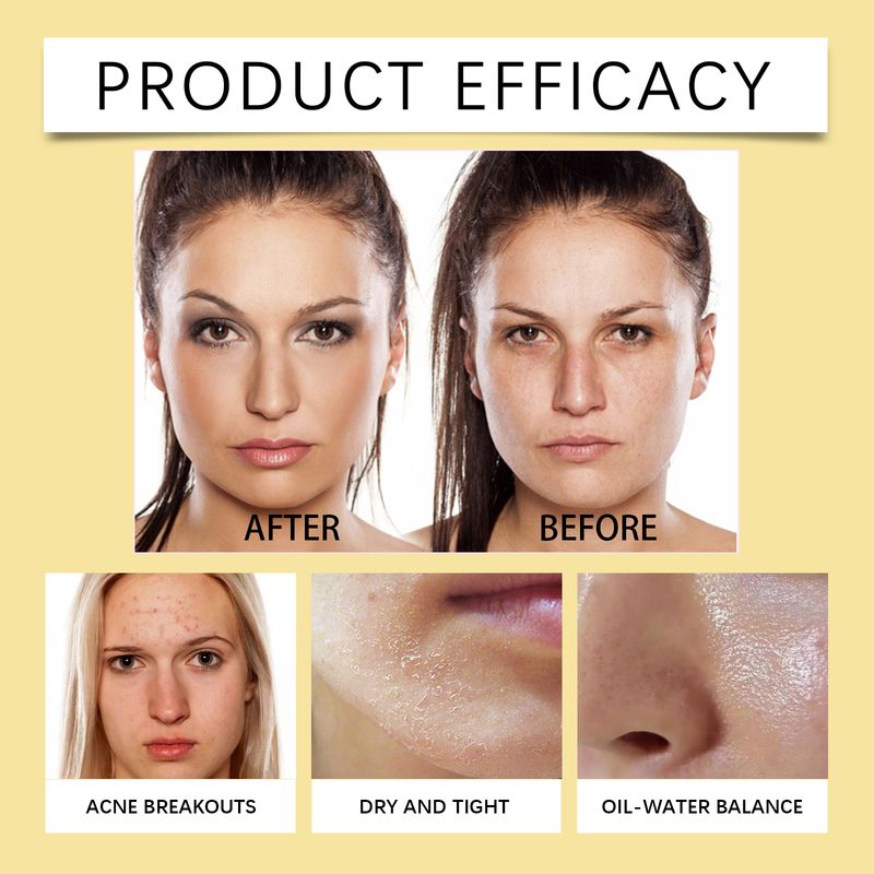 EELHOE Ginger Lemon Temperature Cleansing Facial Skin Refreshing And Non Tight Makeup Removal Water_voghion.com