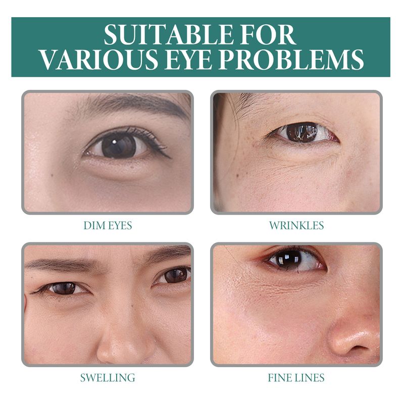 OceAura Puffy Eye Serum, Repair Essence Refreshing Hydrating Firming Brightens The Nicotinamide_voghion.com