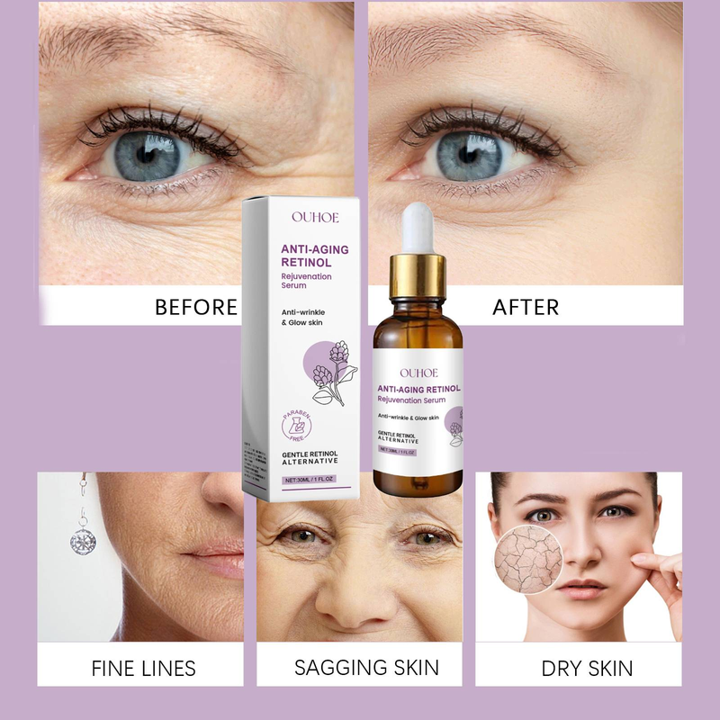 OUHOE Retinol Anti-Falten-Essenz, feuchtigkeitsspendende, straffende und glättende Essenz zur Hautpflege_voghion.com