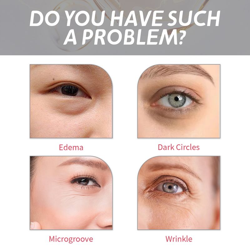 EELHOE Retinol Eye Cream lifts tightens fine lines around crow's tail lines, black circles under the eyes, and_voghion.com