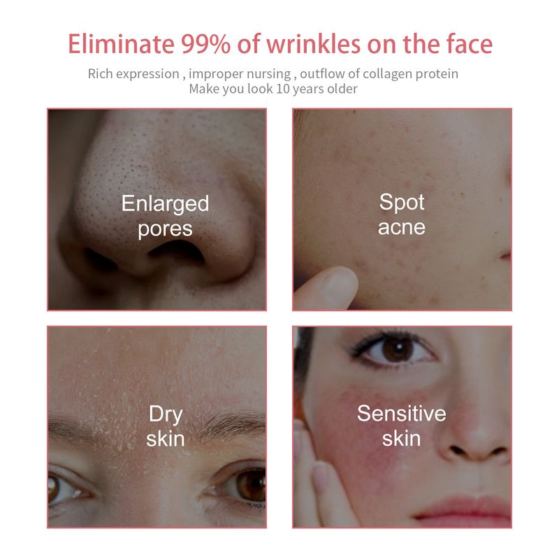 Jaysuing 5-en-1 clansing pour clan pors, marques d'acn lightn, rmov blackhads acn, contrôle du pétrole et des clans fac_voghion.com