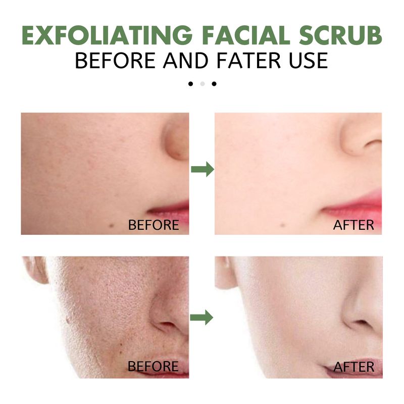 Hoygi Exfoliating Facial Scrub, Deep Cleaning Removes Impurities From Fine Lines Firming Delicate Refreshing Smooth Cream_voghion.com