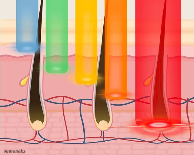 Blinkt Laser Epilierer Laser Vendita Calda Permanente IPL Photo Pilator Haaren Tfernung Schmerzlose Elektrische Epilierer Maschine_voghion.com