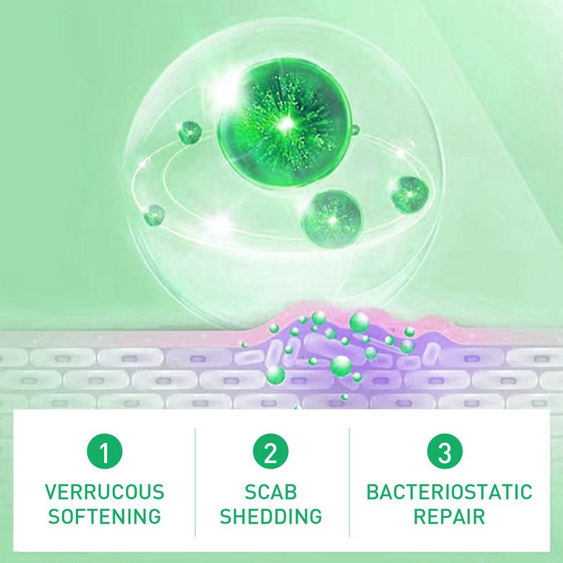 Jaysuing Mild Wart Removing Chicken Eye Smooth Skin and Foot Care Liquid_voghion.com