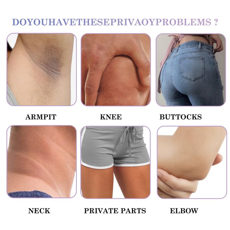 Jayswing Removing&Skin Beautifying spray Melanin Removing&Repairing Joint Black Moisturizing&Whitening lotion_voghion.com