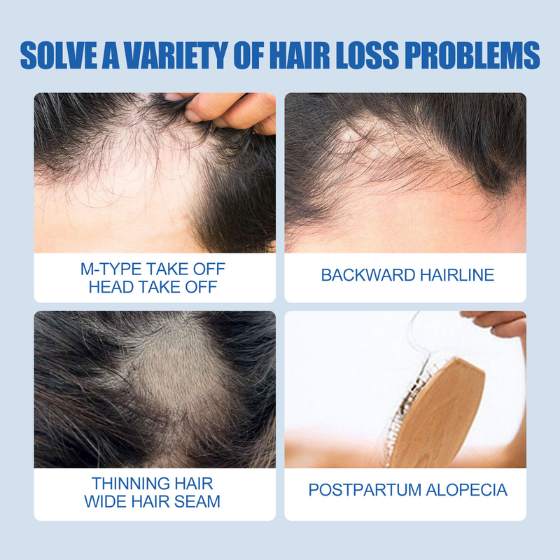 East Moon Loss Prevention Bartpflegekonzentrat für Männer für dickes und festigendes Haar_voghion.com