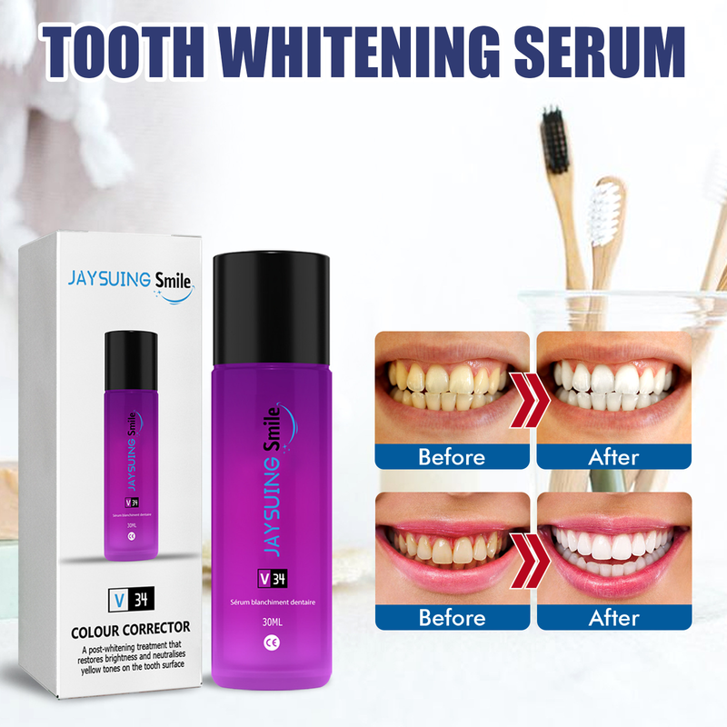 Branqueamento de dentes Jayswing ssnc Bautificação de dente Oral Claning Mancha de dente Placa de dente Clareamento de dente_voghion.com