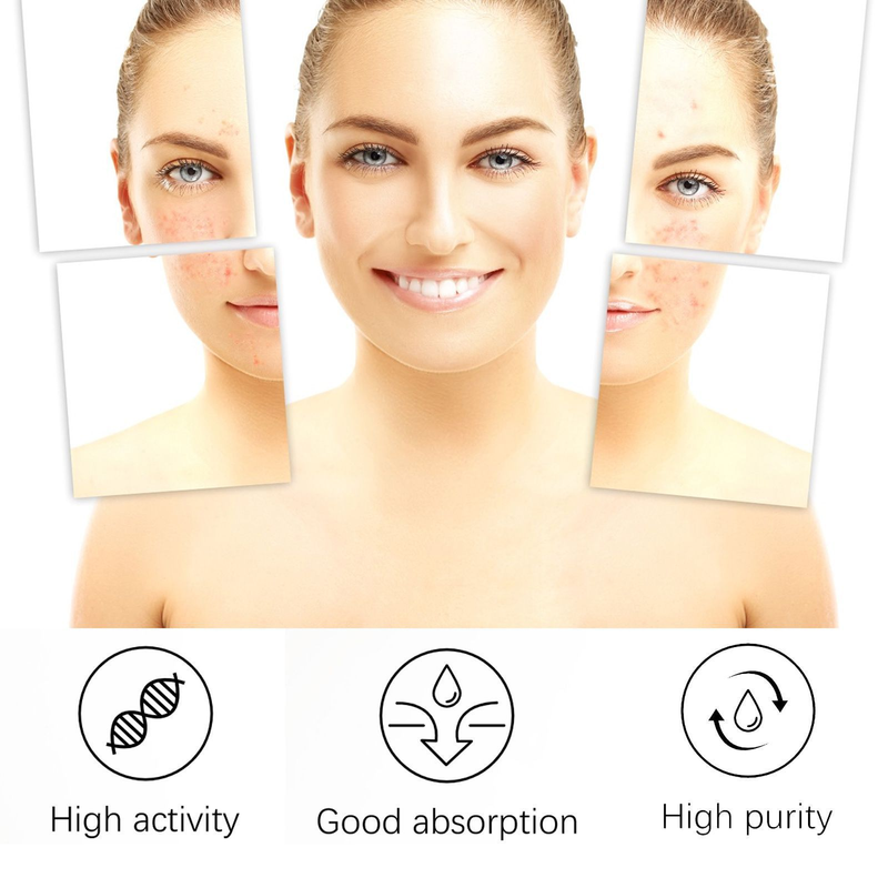 EELHOE Facial Skin Care Cleansing&Reducing Spots, Eliminating Acne and Shrinking Pore essence_voghion.com