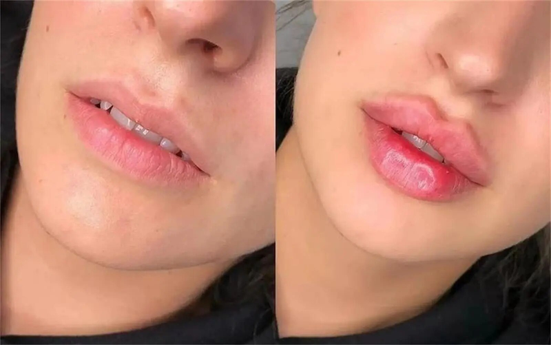 Suero de brillo labial voluminizador instantáneo con aceite realzador y potenciador extremo que nutre y humecta los labios de forma sexy y antiarrugas. El más popular de 2024_voghion.com