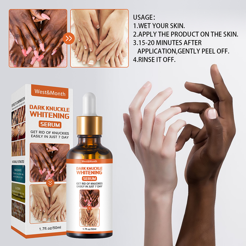 50ml Whitening Serum 7 Days Remover Get Rid Of Dark Knees Dark Knuckle Elbow Cream Nicotinamide Brighten Skin Tone 2023 New_voghion.com
