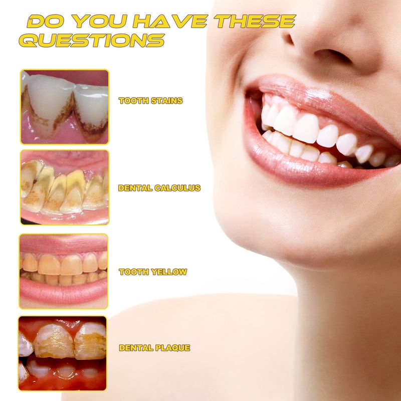 Oralhoe Propolis Oral Cleansing Care Tooth Stain Removal Fresh Mousse Toothpaste_voghion.com