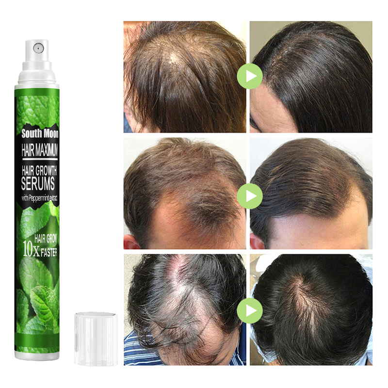 10/30 ml Haarwachstumsspray, schnell wachsendes Haaröl, Haarausfallkur für dünner werdendes Haar, Wachstumsspray, Produkte, Haarpflege für Frauen, Männer, Männer_voghion.com