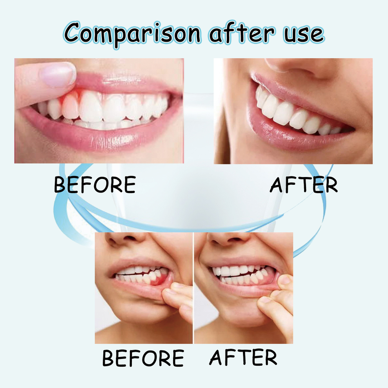 spray Repair Deep Clean Tooth Dirt Fresh Breath Gum Care new_voghion.com