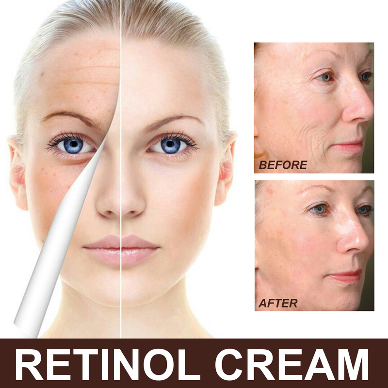 EELHOE Retinol krém arcra, Gyors ránctalanító retinol hidratáló arckrém_voghion.com