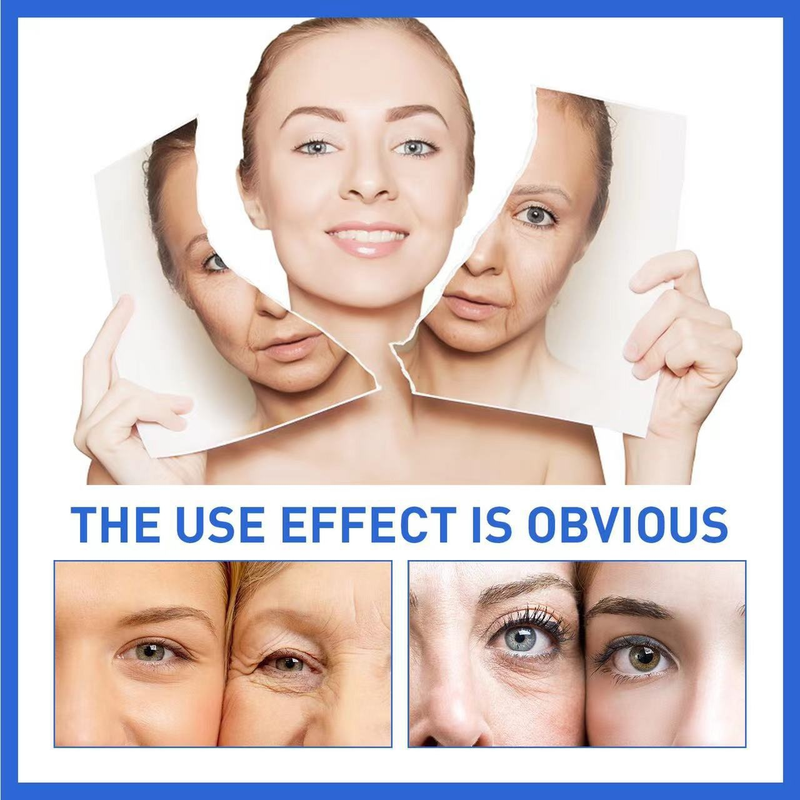 SOL LORA Anti Wrinkle Original Liquid can light fine lines black spots, moisture, tender skin, and prevent aging session_voghion.com