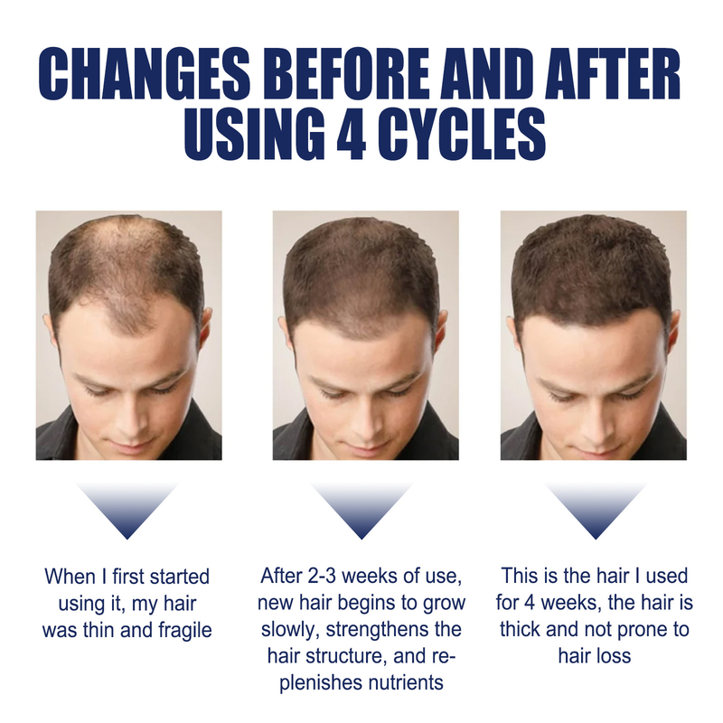 Repairing EELHOE Herbal Root Essence Oil Care Strengthening and Fixing to Prevent Loose Hair_voghion.com