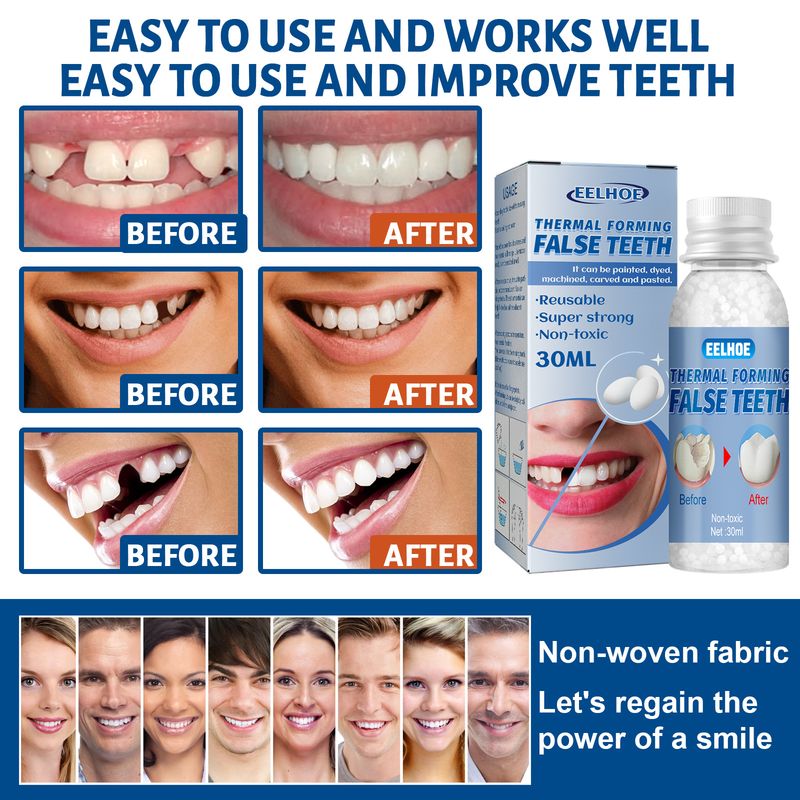 EELHOE Shapeable Glue Film Television Makeup, Artificial Teeth Modification, Temporary Filling, Glue, Dental Hole and_voghion.com