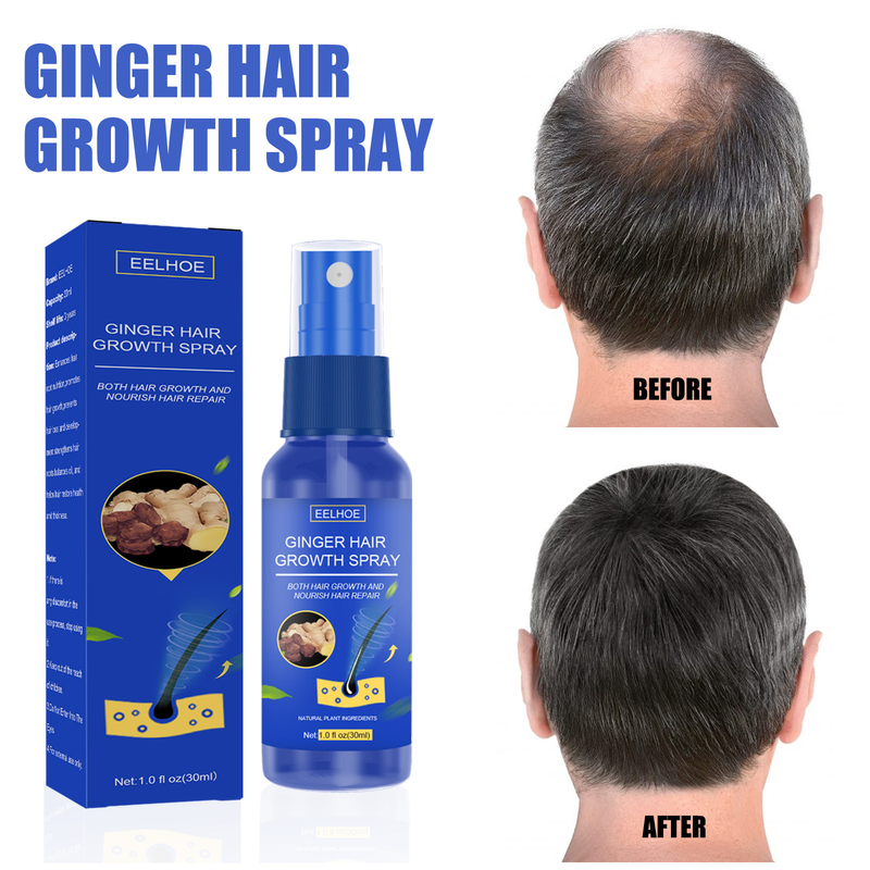 EELHOE Ginger Growth Scalp Massage Moisturizing Thick Hair Care Nutrition Spray_voghion.com