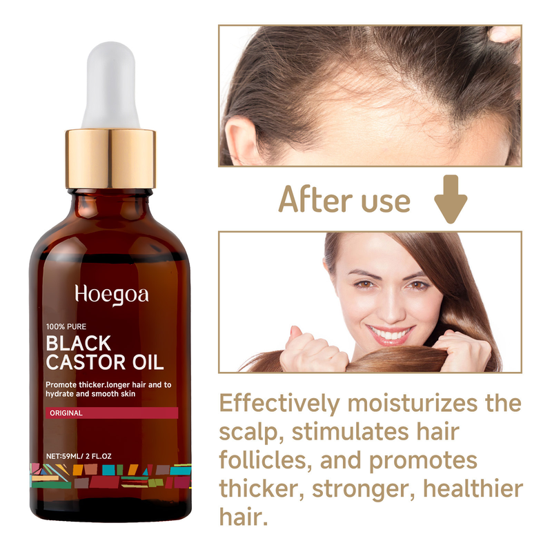 Hoegoa hydrateert reparaties sterk, taai, anti-dropping dicht haar, fixeert haar en verzorgt essentieolie_voghion.com