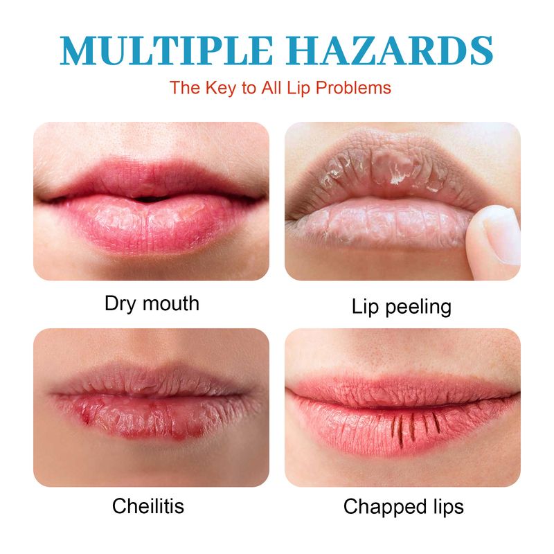 Lip Repair Cream Moisturizes moisturizes the lips, removes dead skin, prevents dryness, and lightens lip lines_voghion.com