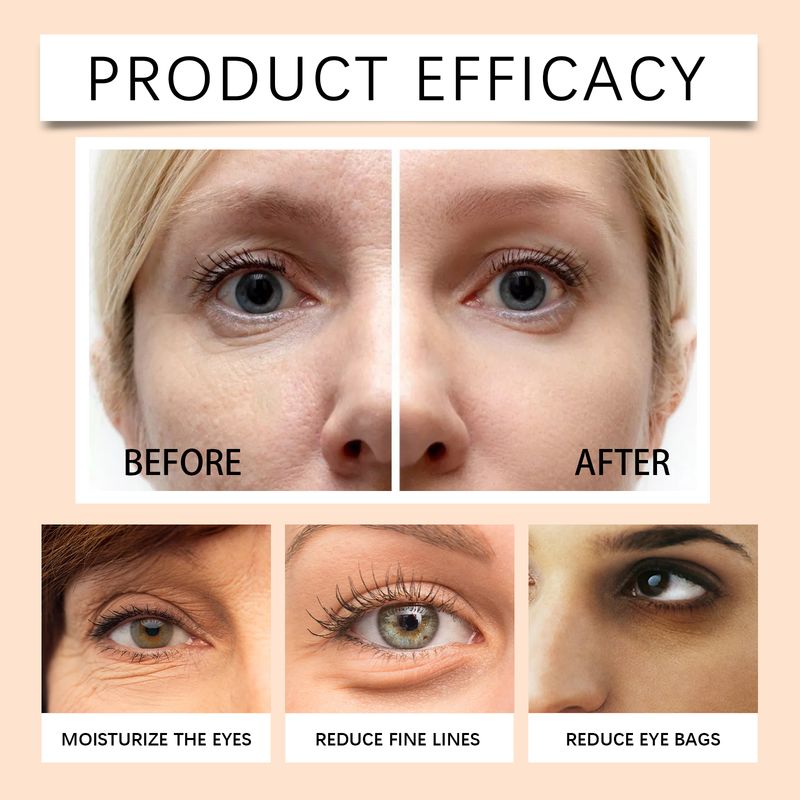 EELHOE Vitamin C Under Eye Patch Bag Care Cool And Moisturize The Skin Around The Eyes Eye Mask Patch_voghion.com