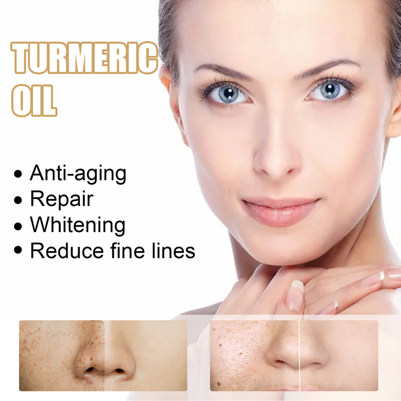 EELHOE Turmeric Black Correction Improve Skin Color essence Facial Care Spot Moisturizing&Moisturizing_voghion.com