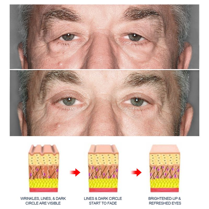 East Moon Anti-Aging Øjencreme Til Mænd, Falmende Øjenlinjer Reparerer Poser Under Øjenet Mørke Rande Fugtgivende Opstrammende Øjencreme_voghion.com