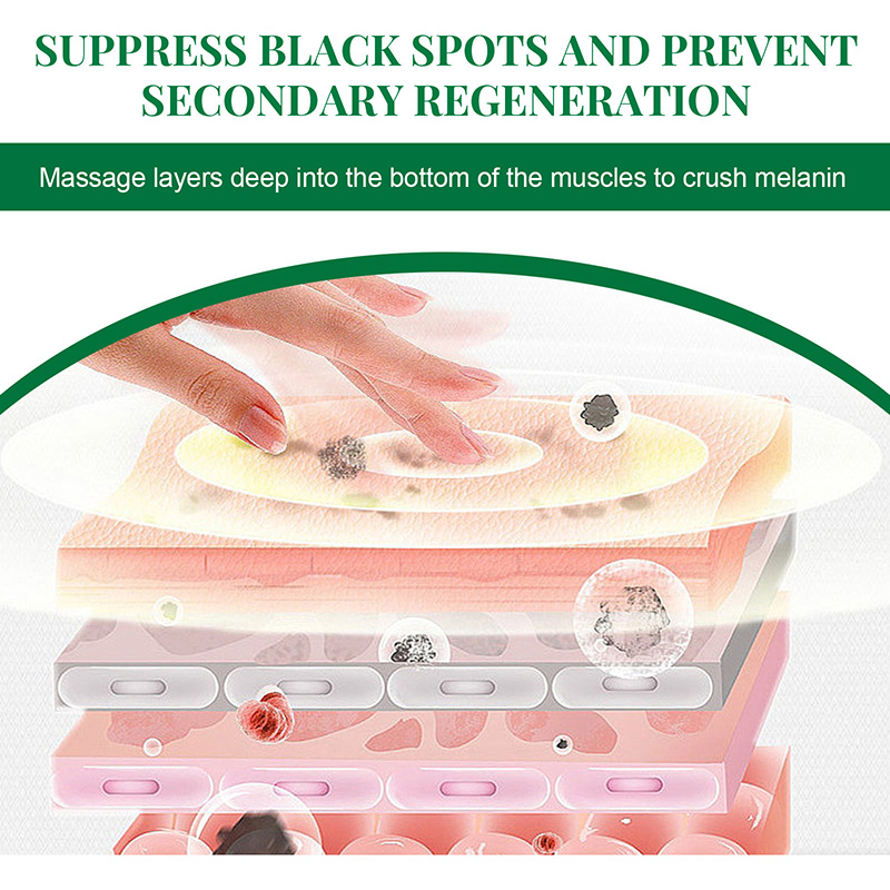 Corrector de manchas oscuras, suero con niacinamida, blanqueador de pecas, esencia para el rostro, elimina las manchas de acné, melanina, desvanece las imperfecciones de la cara_voghion.com